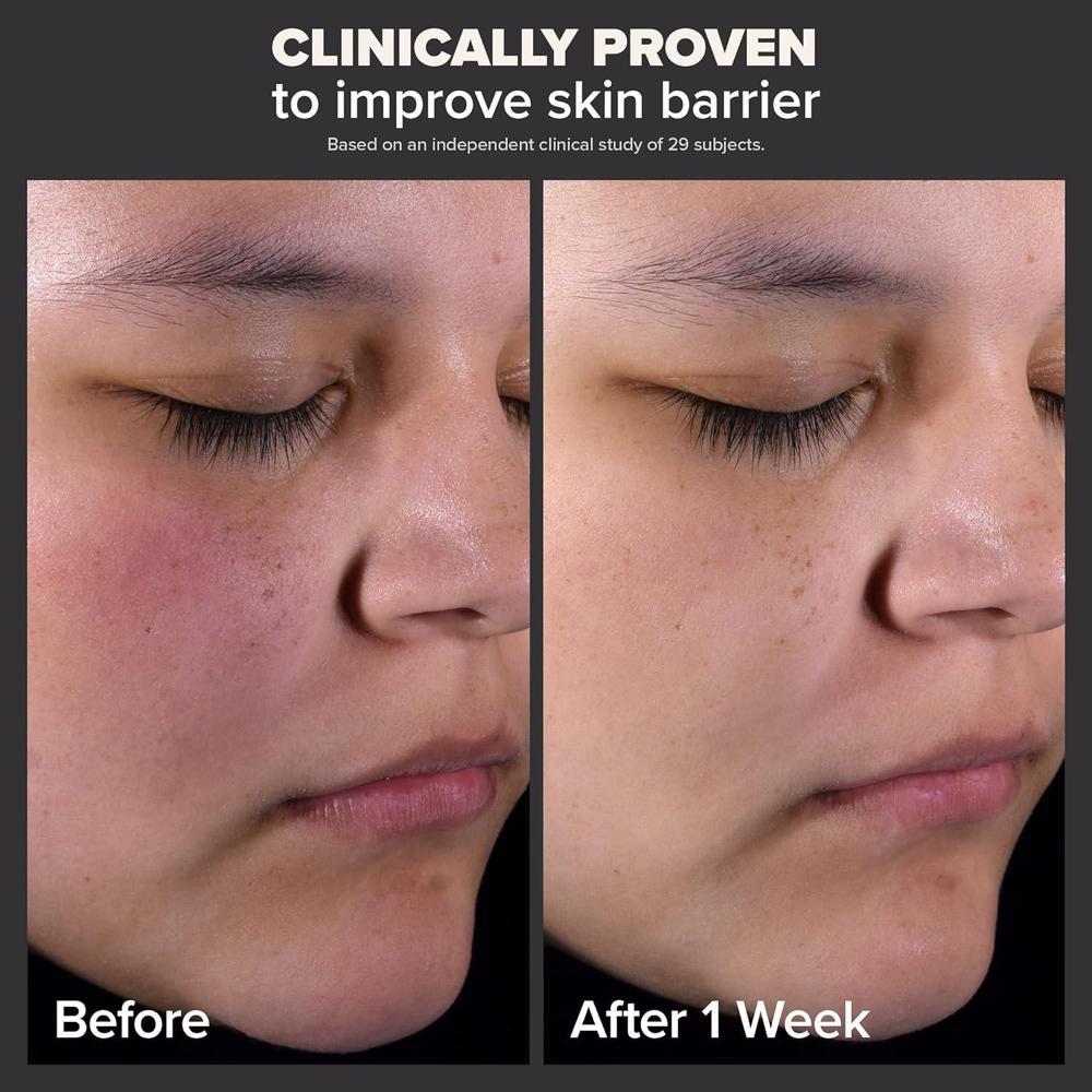 Perfeccionador De Piel Paula's Choice 2% BHA Ácido Salicílico, Exfoliante Líquido Para Puntos Negros Y Poros Abiertos, 118 Ml