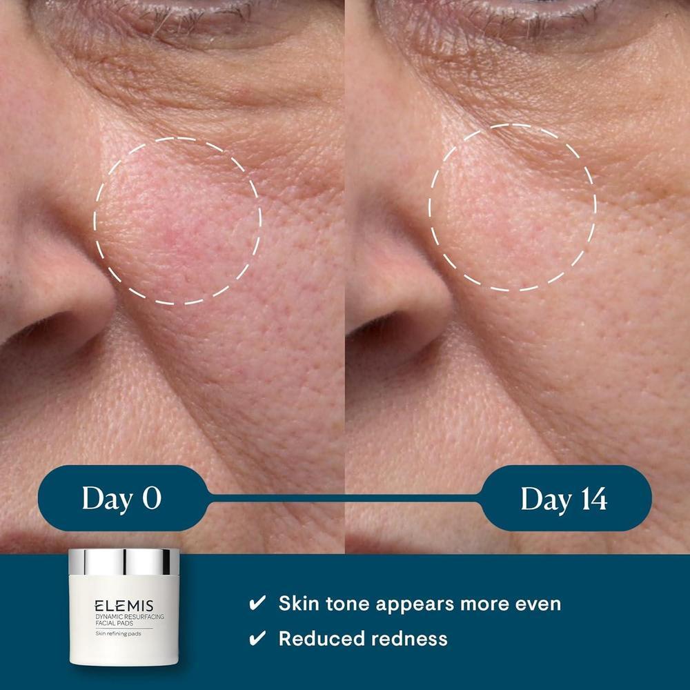 ELEMIS Almohadillas Faciales de Renovación Dinámica, Exfoliantes de Textura Suave para Tratamiento Facial