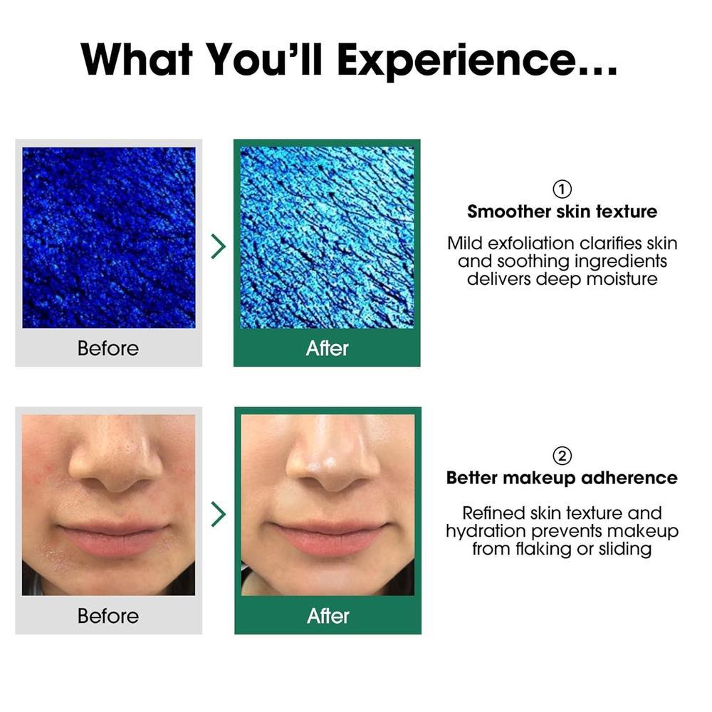 SOME BY MI AHA BHA PHA 30 Days Miracle Toner - Exfoliación suave y cuidado de poros para todo tipo de piel, ideal para piel propensa al acné