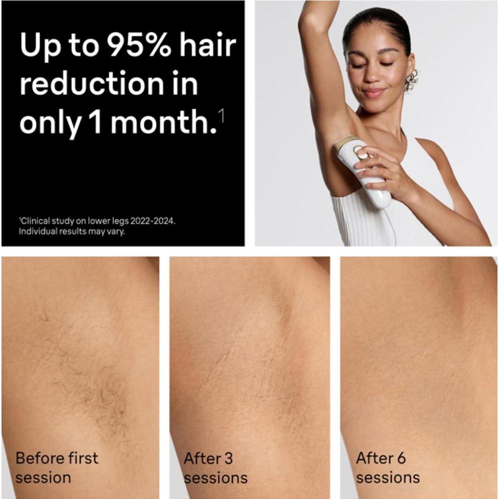 Depiladora láser Braun Silk Expert Pro 5 PL5137 para mujeres y hombres, incluye maquinilla Venus, cableada, uso en cuerpo y cara