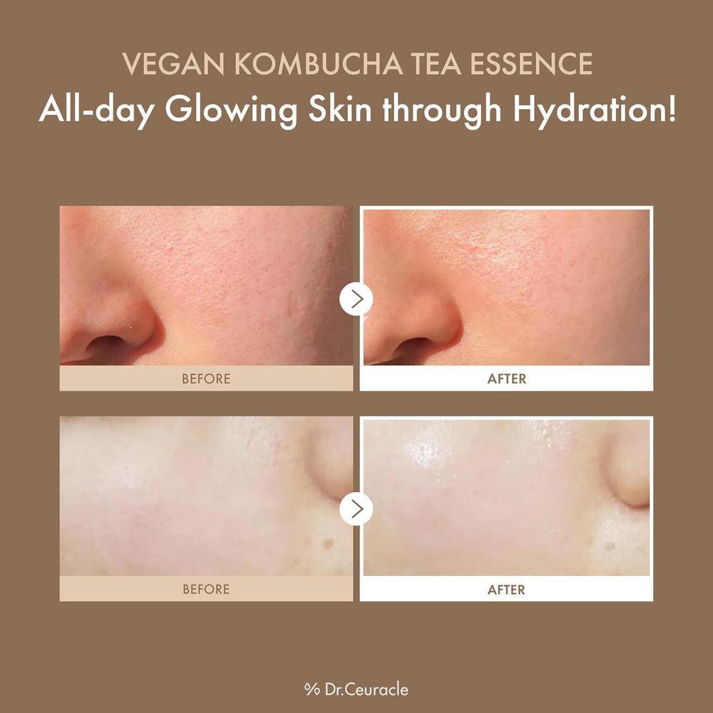 Dr.Ceuracle Esencia Vegana De Té Kombucha Hidratante Con Ceramida 150ml
