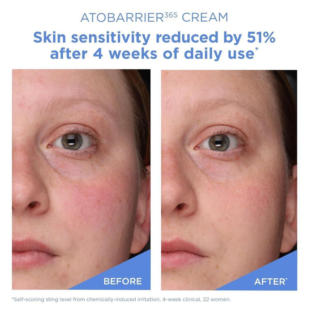Aestura Atobarrier365 Crema Facial Hidratante Con Ceramidas 80ml