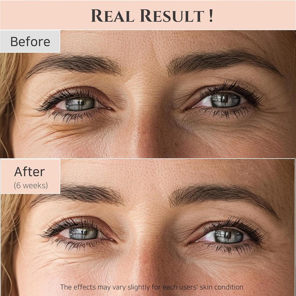 Beauty Of Joseon Retinol Niacinamide Eye Serum 30ml