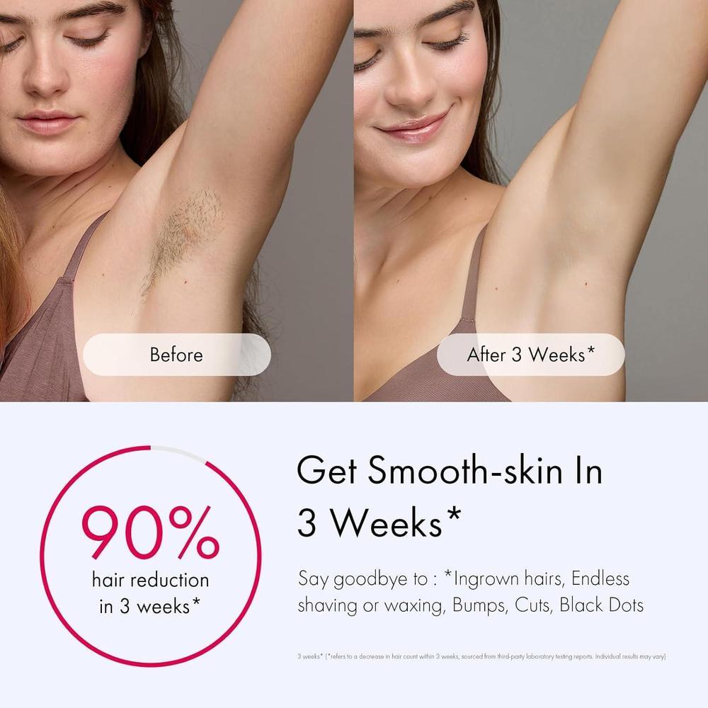 Ulike Depiladora IPL con Enfriamiento de Hielo y 3 Modos, para Resultados Indoloros y Duraderos, Rápida para Todo el Cuerpo