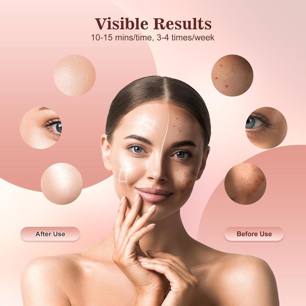 Máscara facial LED INTEO con terapia de luz roja, infrarroja y amarilla. Portátil, 3 modos con control remoto