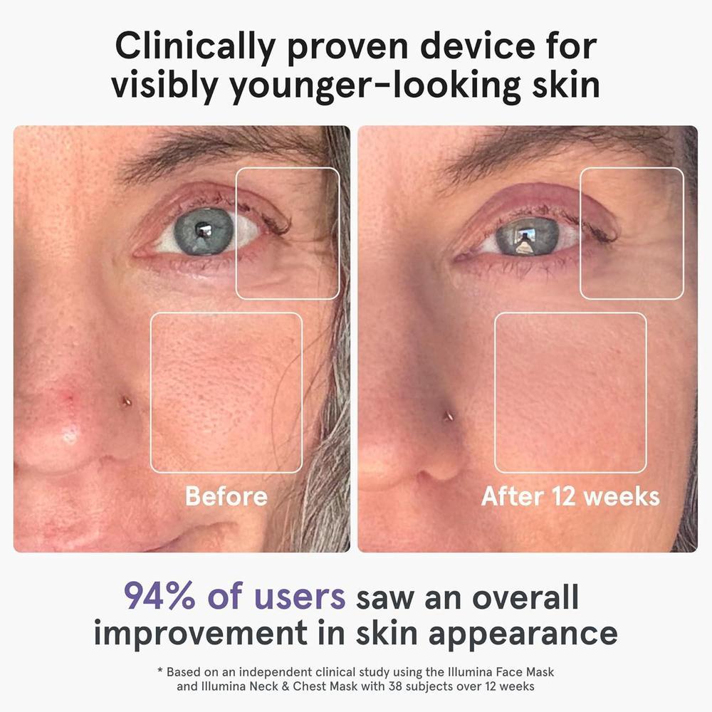 Máscara facial LED iRestore con terapia de luz roja, azul e infrarroja. Rejuvenece la piel y reduce arrugas, líneas finas y manchas oscuras