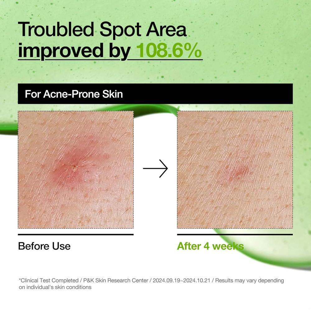 Suero Anua Ácido Azelaico 10% Hialurónico 30ml