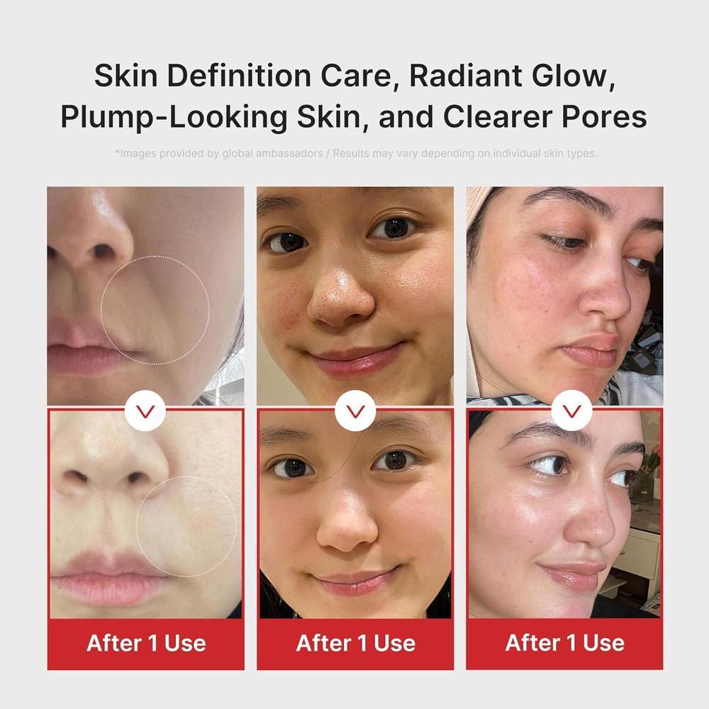 Medicube Age-R Booster Pro 6-en-1 Masajeador de Belleza para Piel Radiante y Firme con Tecnología Coreana