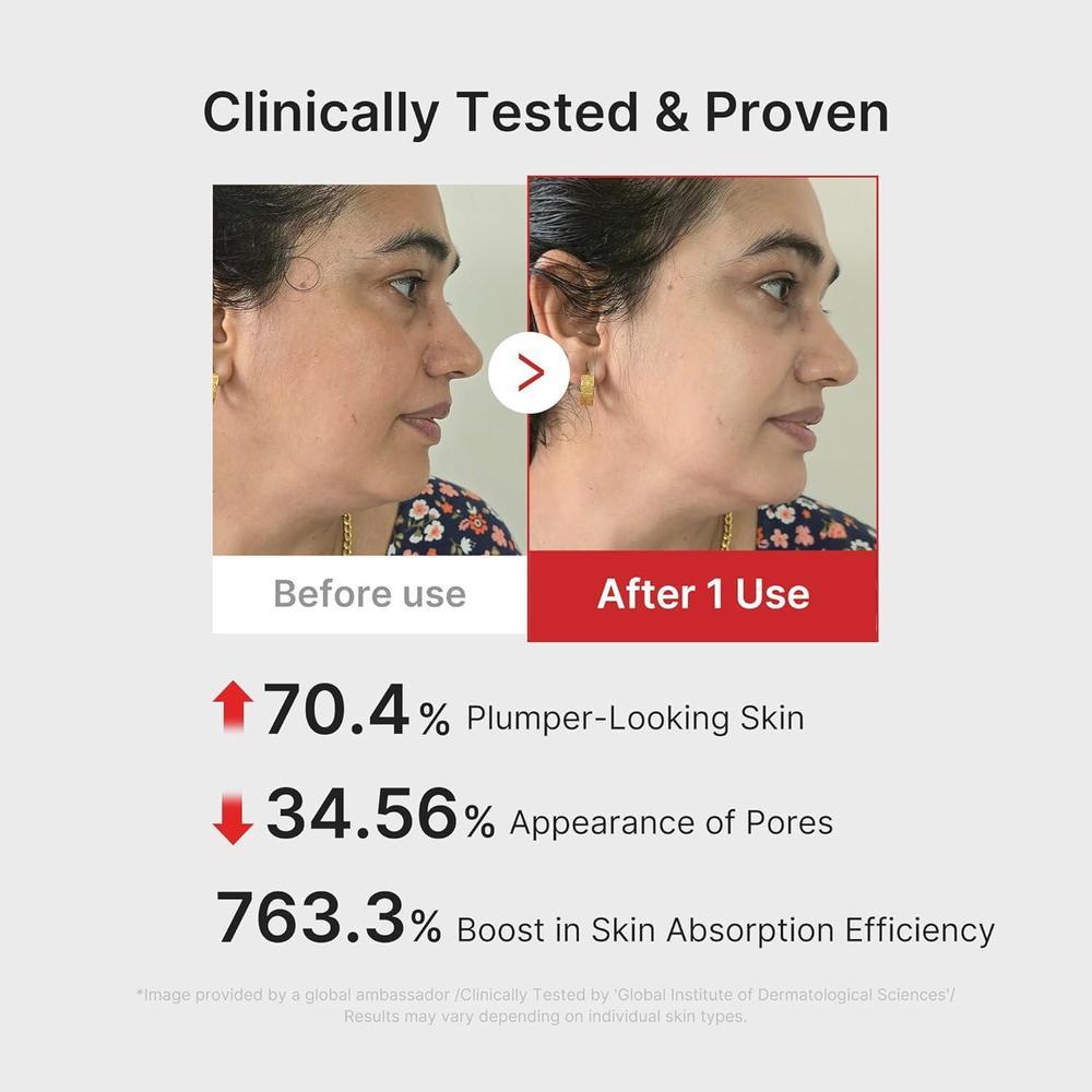Medicube Age-R Booster Pro 6-en-1 Masajeador de Belleza para Piel Radiante y Firme con Tecnología Coreana