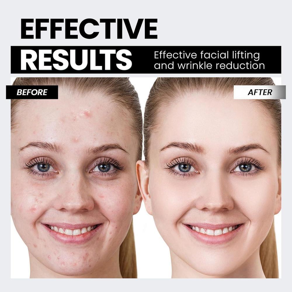 Dispositivo Facial con Tecnología de Microcorriente y Luz Roja para Levantar el Rostro y Tensar la Piel, Antiarrugas Inteligente