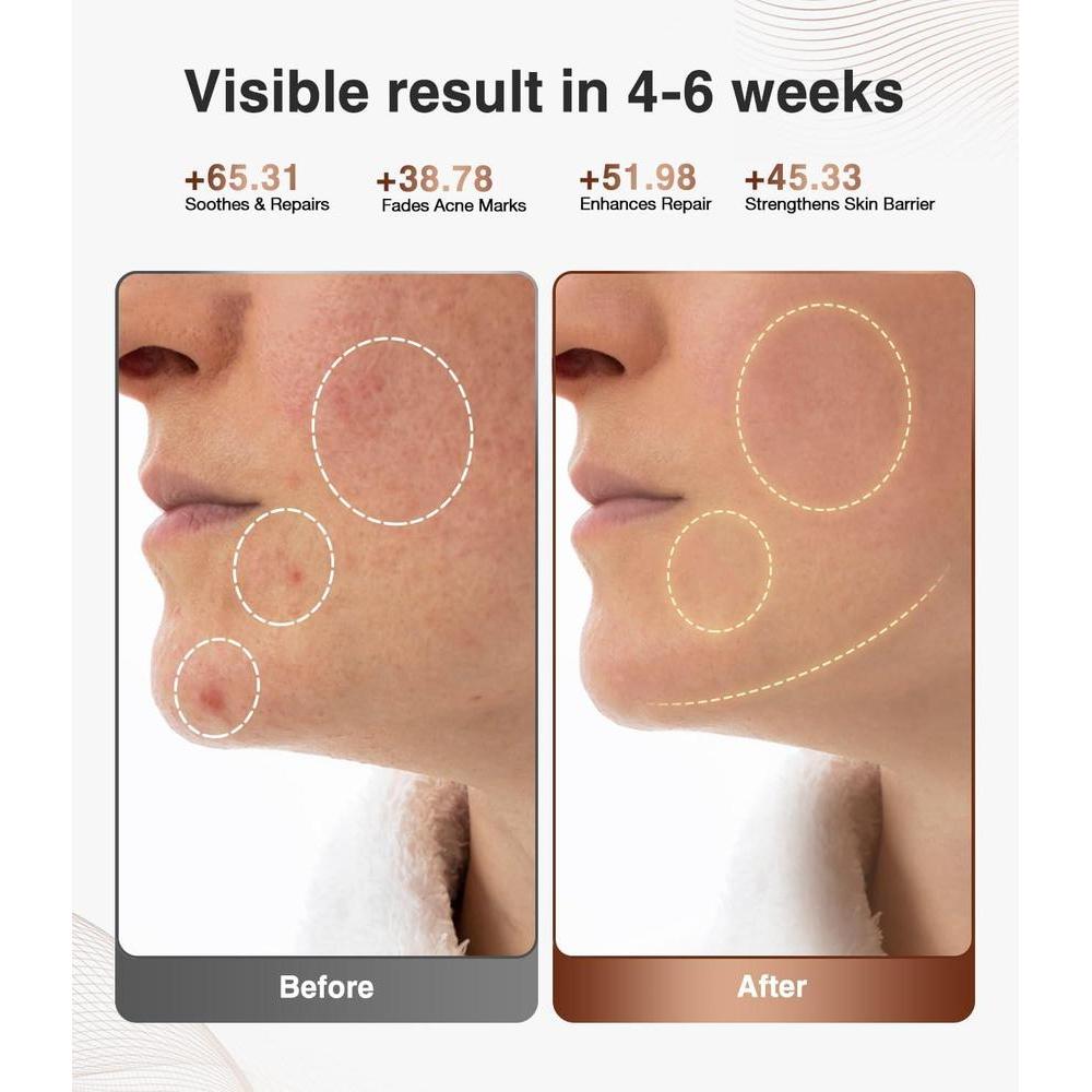 Máscara de terapia de luz roja JOVS para rostro, con 4 modos y herramientas portátiles para cuidado de la piel en casa