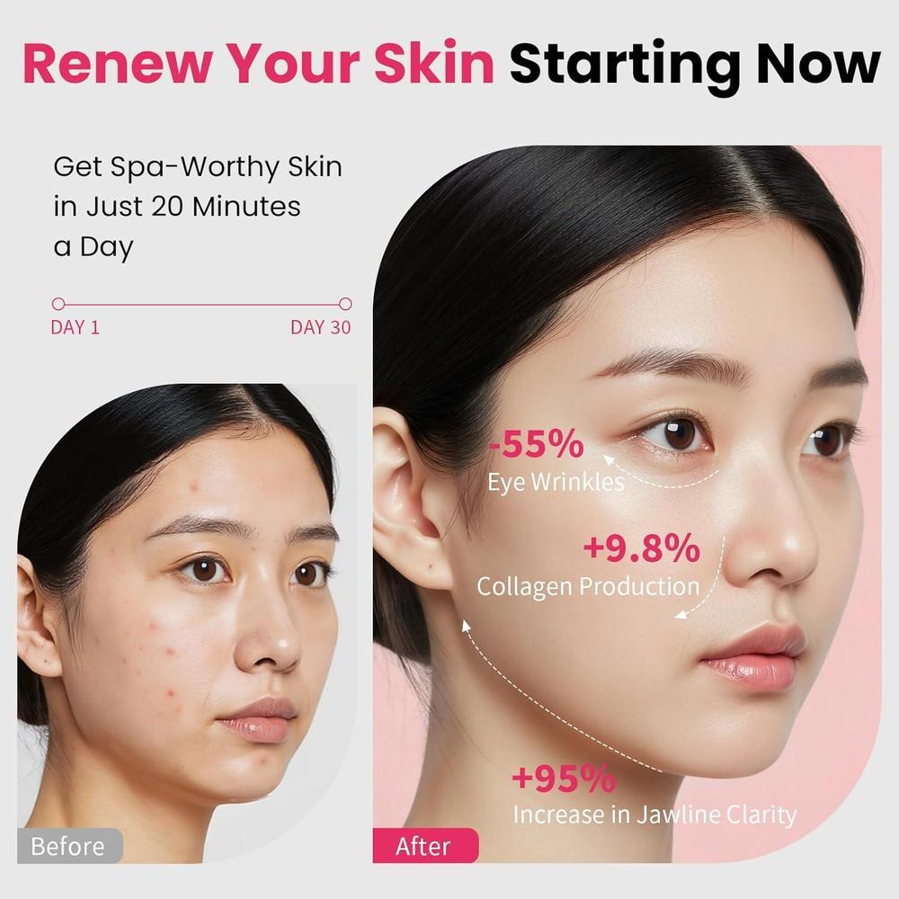 Dispositivo facial 8 en 1 para estiramiento, lifting, terapia LED, masaje vibrante y calidez, cuidado de piel tipo spa en casa