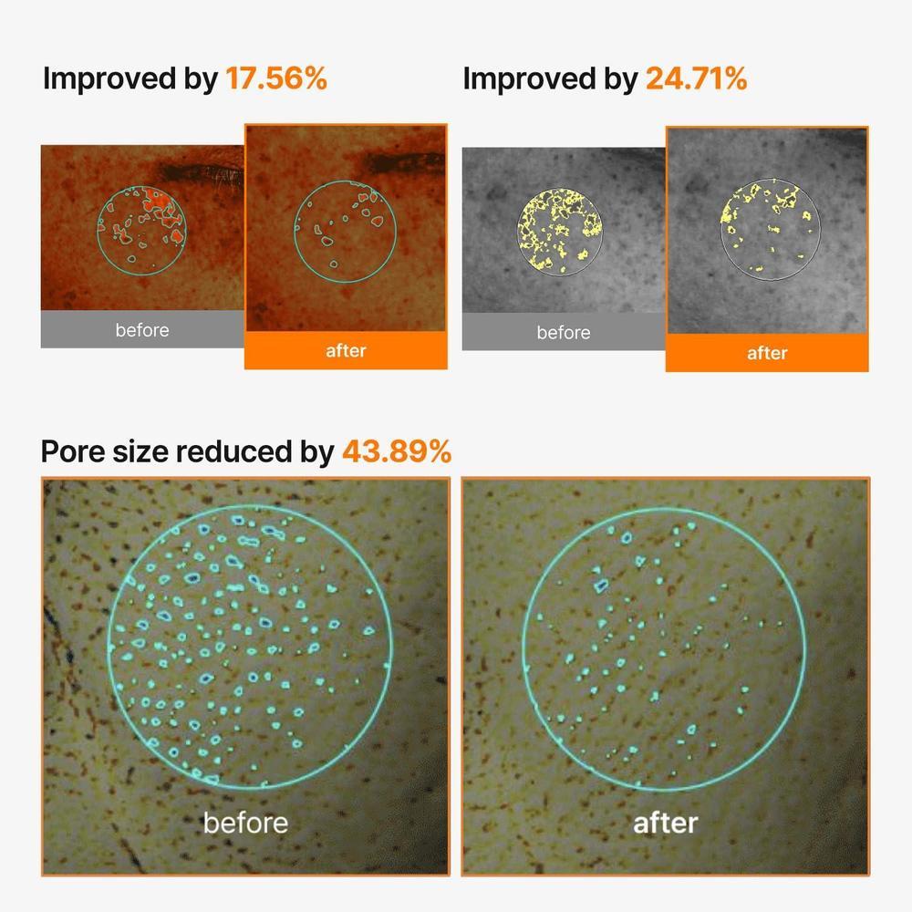 Máscara de Crema Iluminadora de Poros y Manchas Oscuras con Niacinamida y Ácido Tranexámico, Hidratante y No Irritante