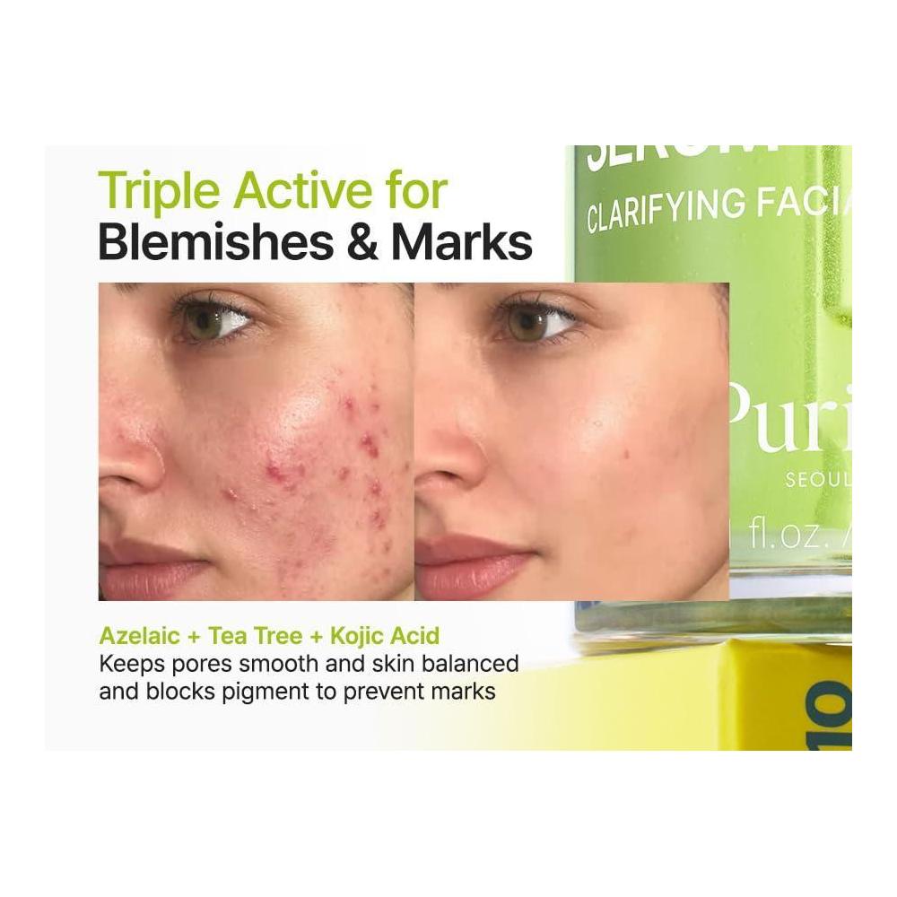 Purito Serum Facial Acido Azelaico 10% Acido Kojico Arbol De Te 30ml