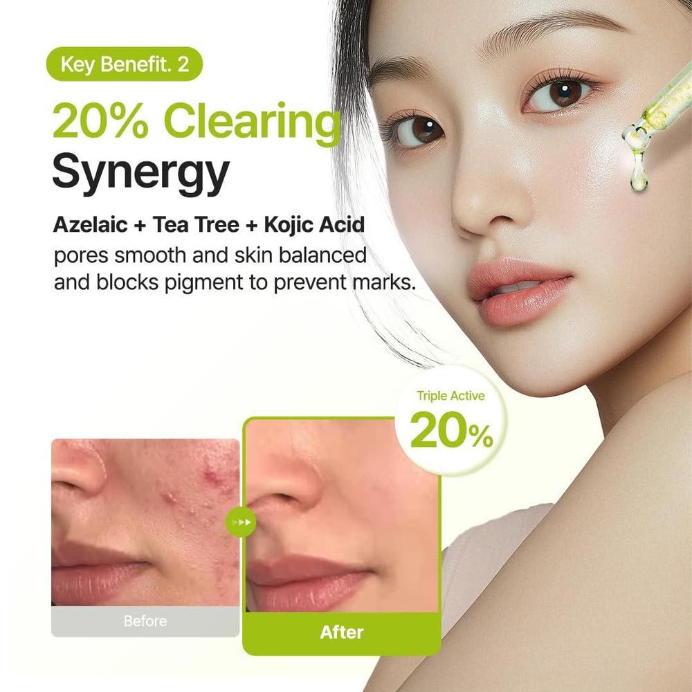 Purito Serum Facial Acido Azelaico 10% Acido Kojico Arbol De Te 30ml