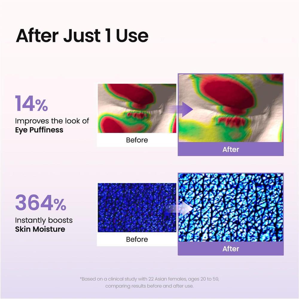 BIODANCE Parches oculares Caviar PDRN para círculos oscuros, ojos hinchados, nutrición profunda, regalo ideal